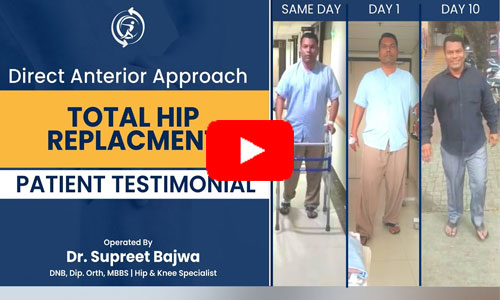 Hip video